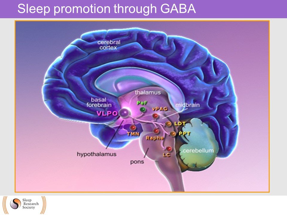 image of brain on module slide